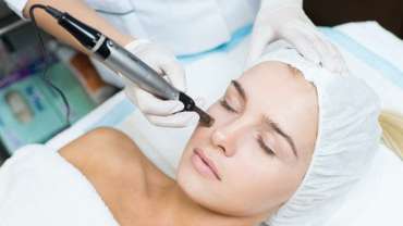 Dermapen Facial