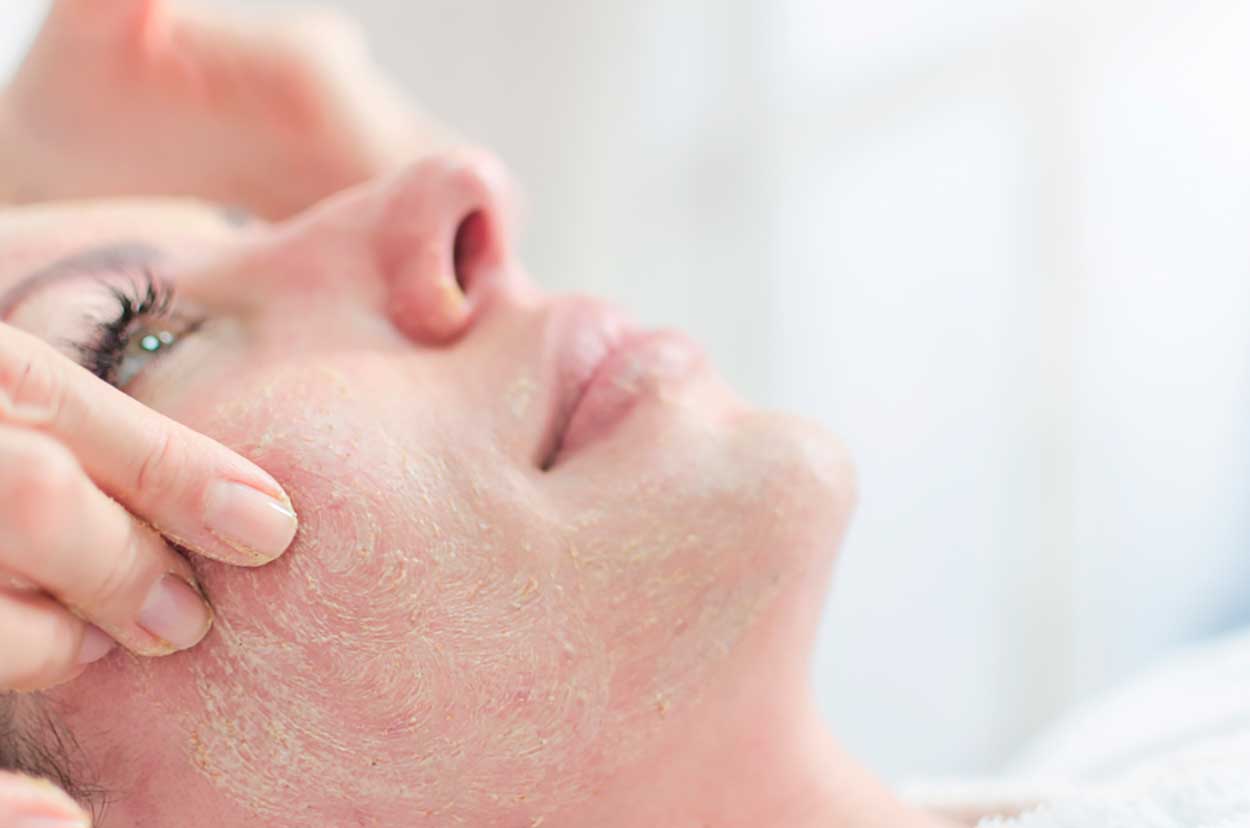 Ventajas del peeling facial: tipos y precios.