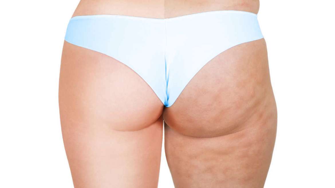 Mesoterapia en Madrid