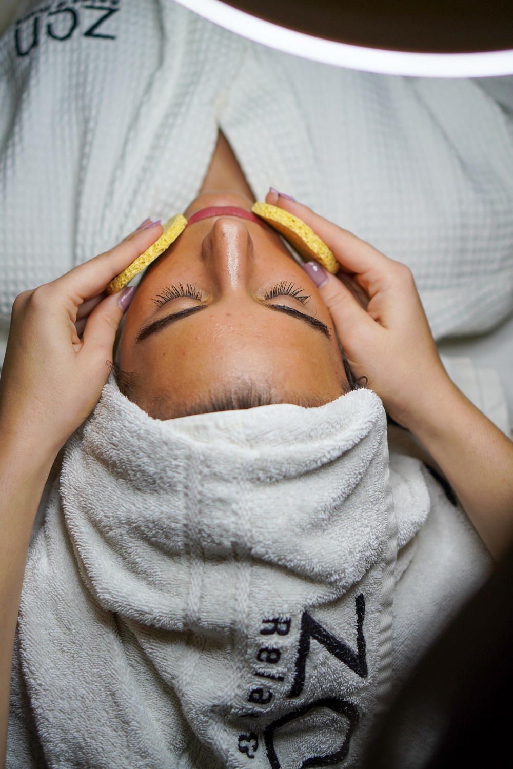 Eliminación de Manchas en la Piel Mediante Peeling Químico: Un Resplandor Renovado
