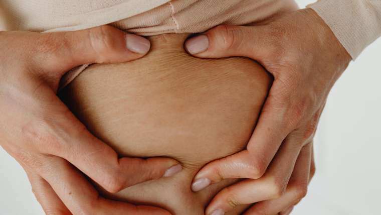 Adiós a las Estrías: Cómo Recuperar la Elasticidad de la Piel